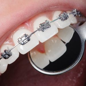 Чому важливо звертатися в професійну стоматологічну клініку