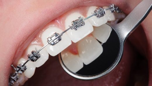 Чому важливо звертатися в професійну стоматологічну клініку
