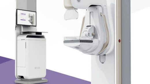 Что такое цифровые маммографы и почему важно покупать качественные модели